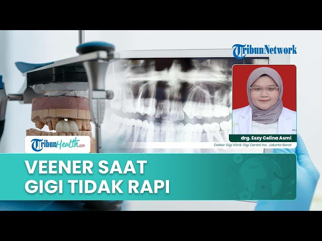 Youtube Thumnail image of : Gigi yang Masih Berantakan, Bisa Langsung Veneer atau Harus Dirapikan Dulu?